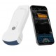 Портативний УЗД сканер Портативний УЗД сканер