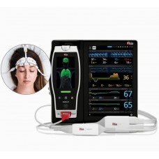 Мониторинг мозговой активности SedLine O3 на платформе Masimo ROOT