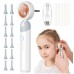 ​​​​​​​Цифровий портативний відеоотоскоп E-Lite P5