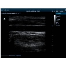 УЗД для ветеринарії Mindray DP10
