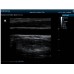 УЗД для ветеринарії Mindray DP10